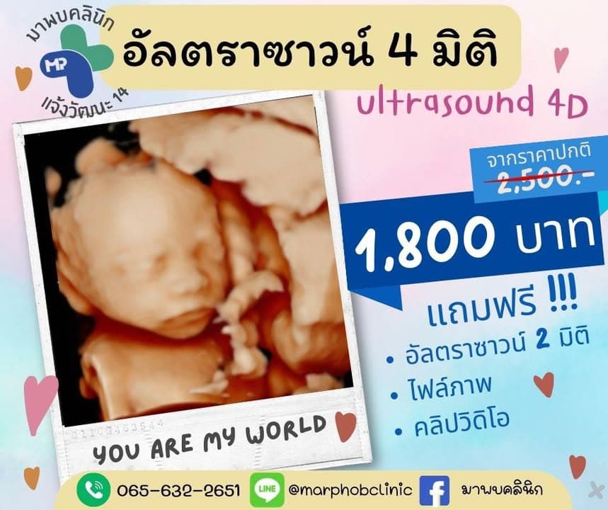 อัลตราซาวด์ 4 มิติ